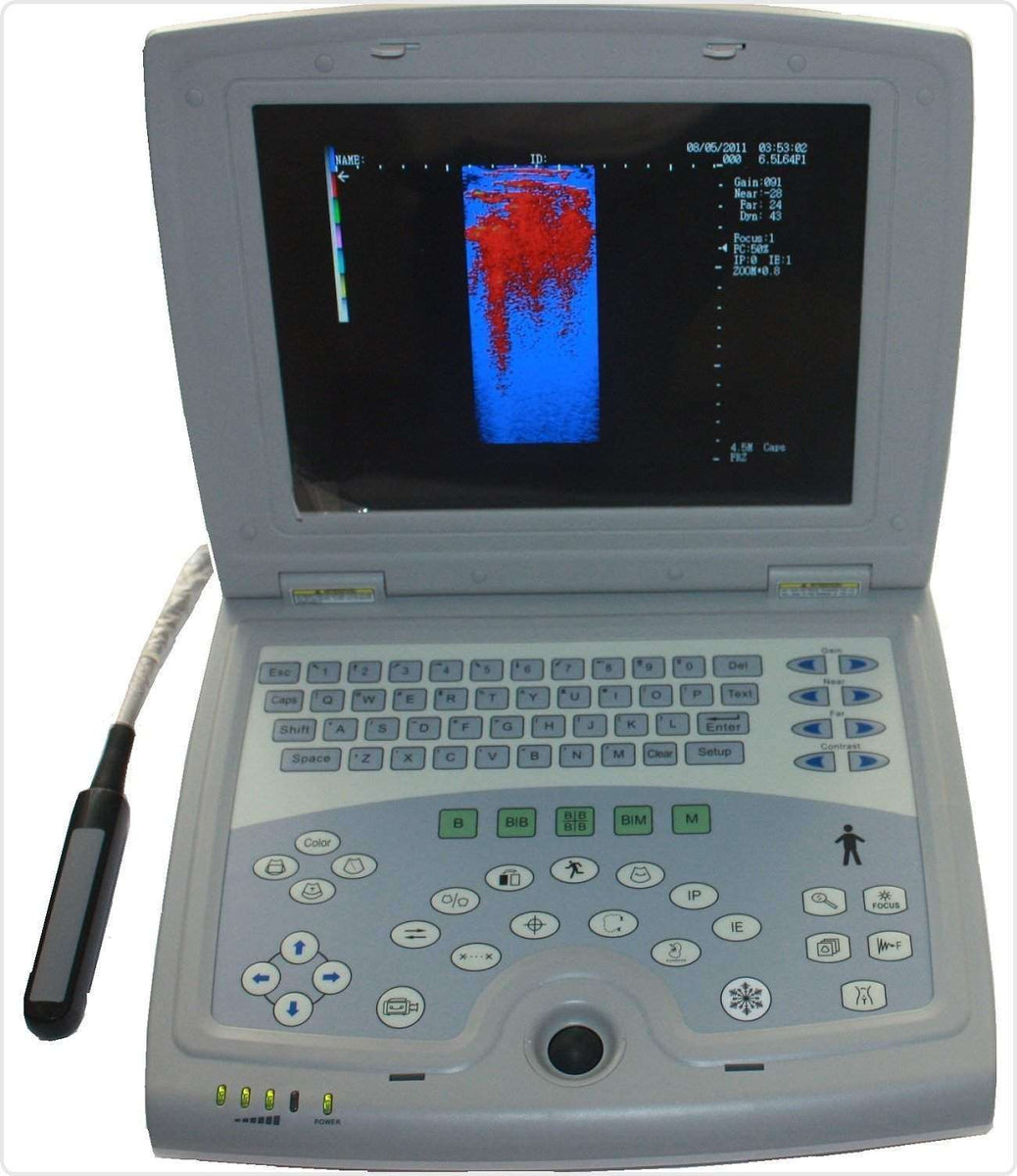 KX-5000V Laptop