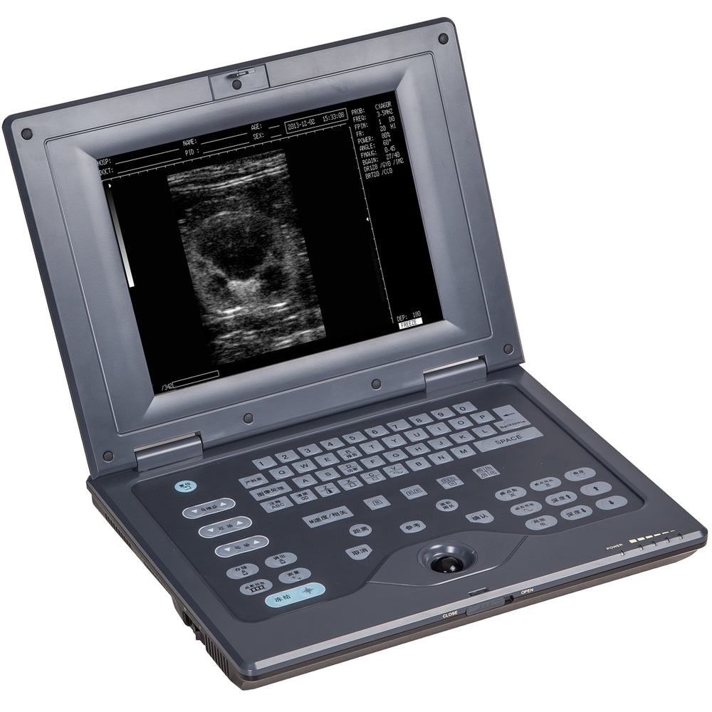 
                  
                    ECO-5000V Veterinary Laptop Ultrasound, Large Animal, Bovine, Horse Refurbished
                  
                