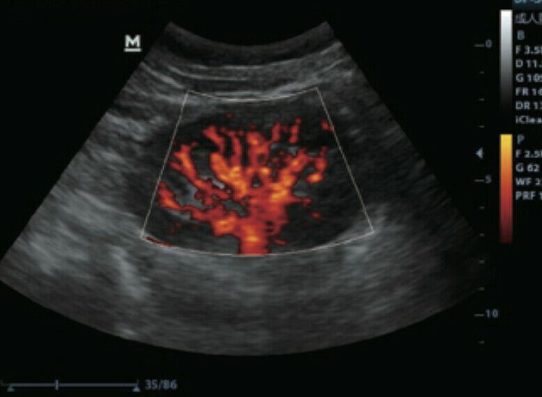 
                  
                    Veterinary Color Doppler Ultrasound & Micro convex probe for Small animals
                  
                