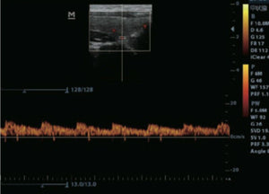 
                  
                    Veterinary Color Doppler Ultrasound & Micro convex probe for Small animals
                  
                