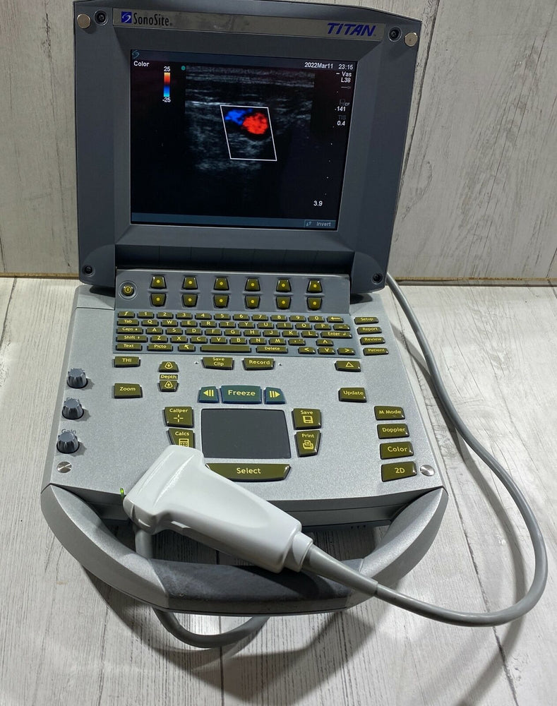 
                  
                    Sonosite Titan  Portable Ultrasound 2005 - With Linear Array probe L25 Probe
                  
                