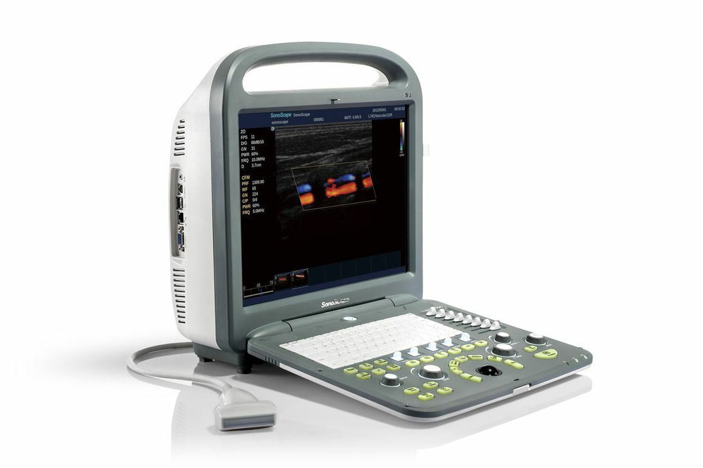 
                  
                    SonoScape S2 with convex Probe Abdominal Ultrasound
                  
                