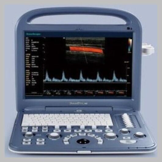 
                  
                    SonoScape S2 with convex Probe Abdominal Ultrasound
                  
                