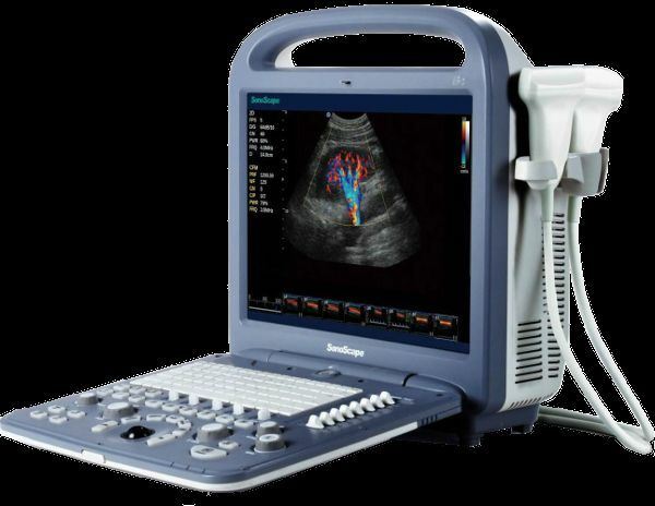 
                  
                    SonoScape S2 with convex Probe Abdominal Ultrasound
                  
                