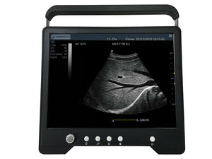 
                  
                    Veterinary Large & Small Animal Touch Screen Ultrasound w/ Two Probes | KeeboMed
                  
                