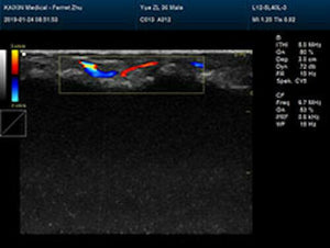 
                  
                    Newest- Color Portable Ultrasound & One Probe, DICOM, LED screen
                  
                