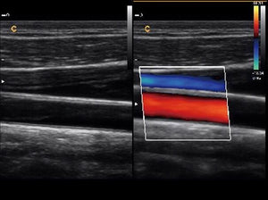 
                  
                    Veterinary Ultrasound Chison Q9 Color Doppler & Micro-Convex Small Animals Probe
                  
                