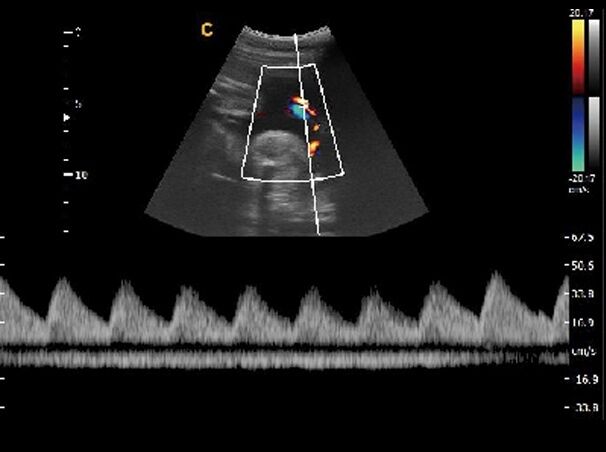 
                  
                    Veterinary Ultrasound Chison Q9 Color Doppler & Micro-Convex Small Animals Probe
                  
                