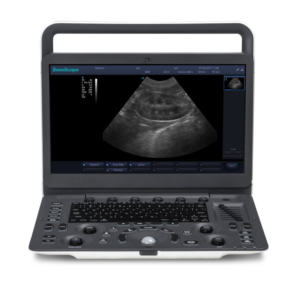 
                  
                    Veterinary Ultrasound Sonoscape A6V Expert (E1V) With Rectal and Micro Convex
                  
                