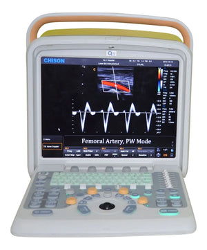 
                  
                    Veterinary Ultrasound Scanner with one  Probes - Color Doppler Chison Q5Vet
                  
                