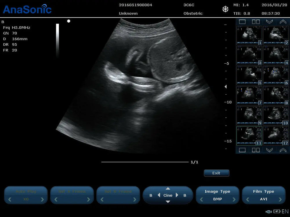 
                  
                    Veterinary Ultrasound Color Doppler, Quality Continuous Wave CW & Two Probes, C7
                  
                