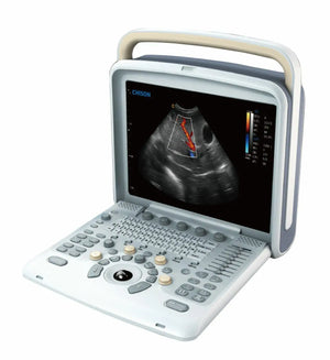 
                  
                    Veterinary Ultrasound Scanner with one  Probes - Color Doppler Chison Q5Vet
                  
                