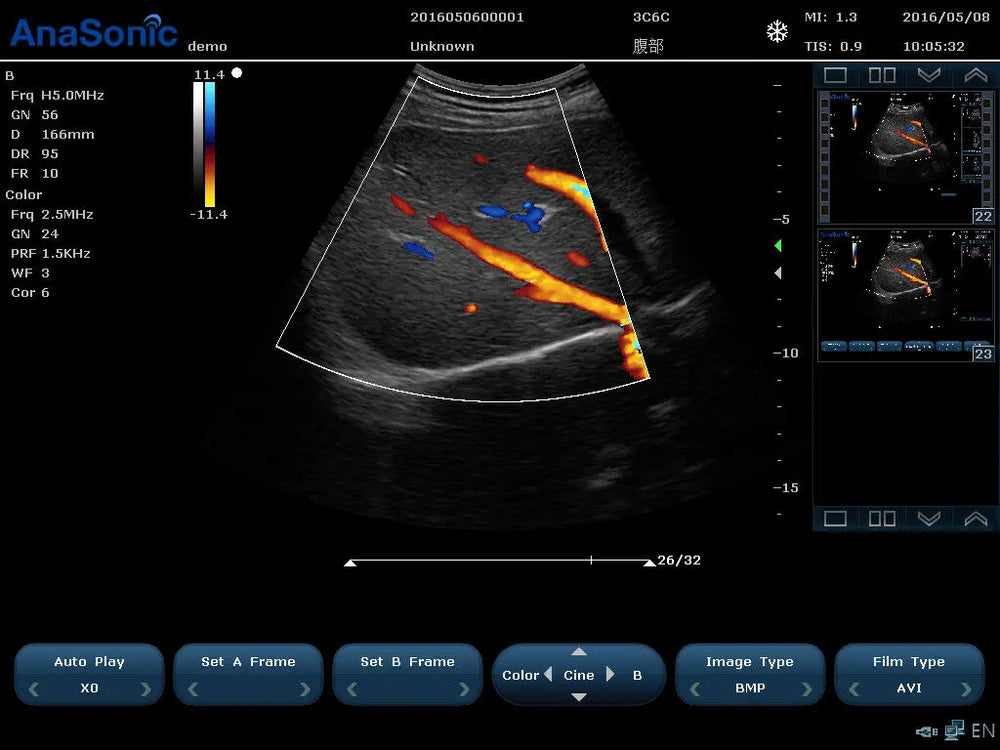 
                  
                    Veterinary Ultrasound Color Doppler, Quality Continuous Wave CW & Two Probes, C7
                  
                