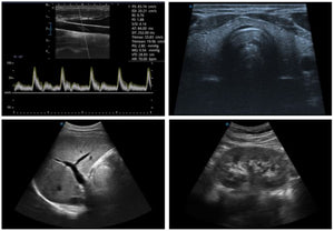 
                  
                    SonoScape A6V Expert (E1V) Veterinary Ultrasound and 4-13MHz Micro-Convex Probe
                  
                