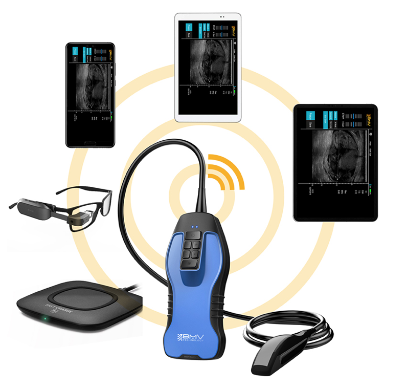 Portable Wireless Bovine Imaging Ultrasound Scanner,  iOS and Android Compatible