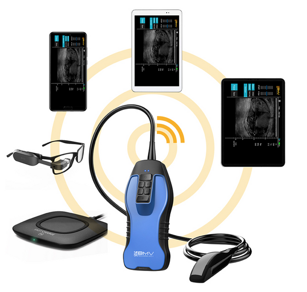 wireless Ultrasound Probe ATL - Wifi Ultrasound probes