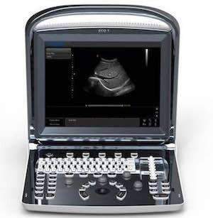 
                  
                    Chison ECO 1Vet,Portable Ultrasounds,Chison,KeeboVet Veterinary Ultrasound Equipment.
                  
                