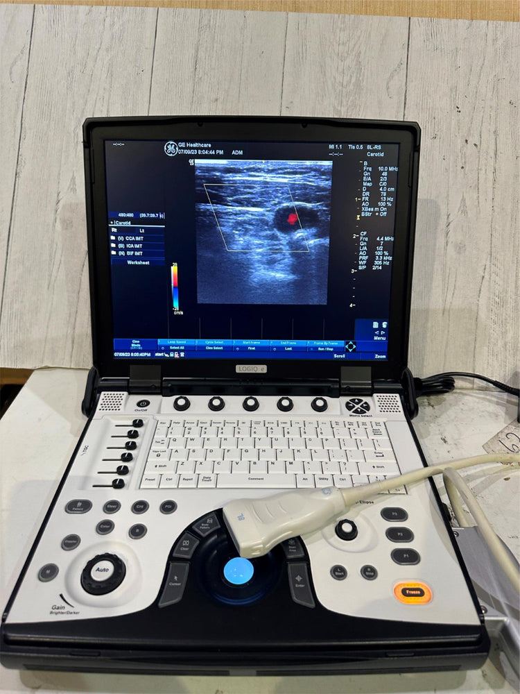 BT12 GE LOGIQ E Next Ge Ultrasound 2013, Vascular & 8L-RS probe