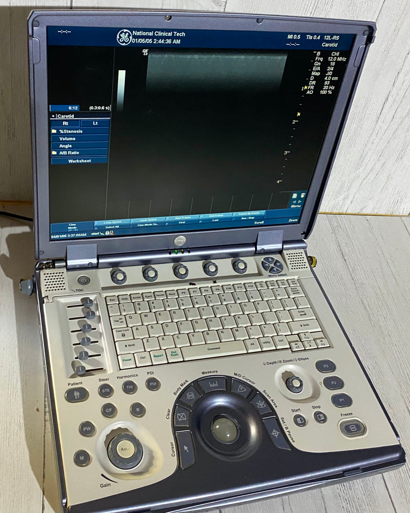 
                  
                    Ge Logic E portable Ultrasound machine with one linear array probe L8-8S
                  
                