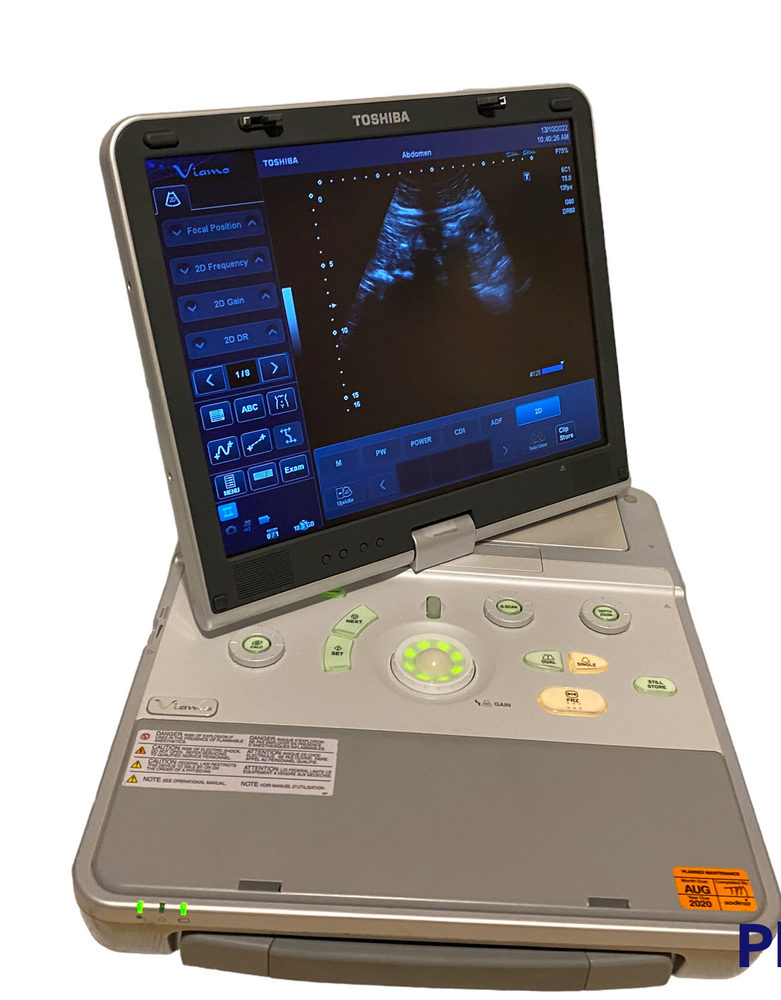 
                  
                    Toshiba Viamo Portable Ultrasound Machine 2013
                  
                