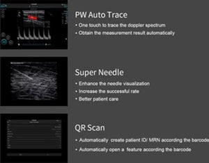 
                  
                    Supper Small Chison SonoEye  P1 Linear Array for android Color Doppler Vascular
                  
                