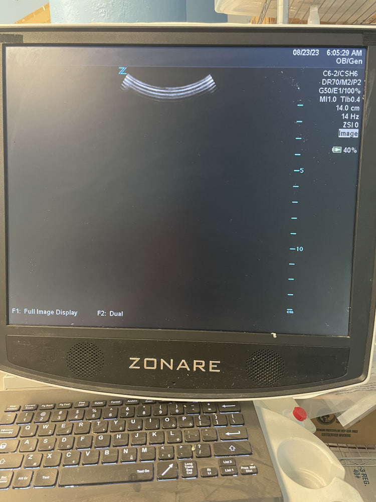 
                  
                    ZONARE C6-2 Ultrasound Probe Transducer
                  
                