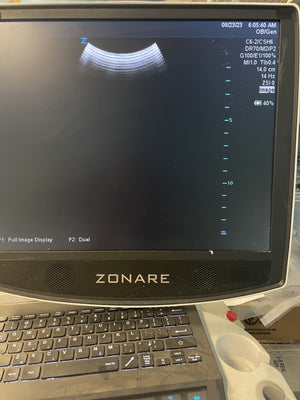 
                  
                    ZONARE C6-2 Ultrasound Probe Transducer
                  
                